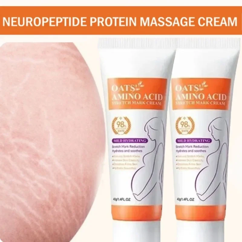 Krem na rozstępy Trwałe usuwan – Skincare Oat recenzja i cena